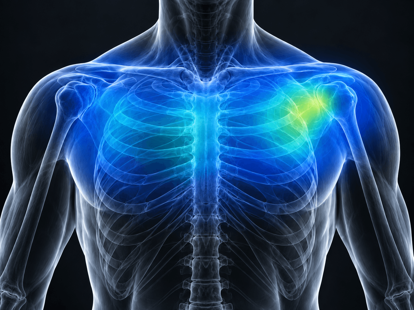 Illustration of blue and green impact force spread over the upper torso with Kinetic Weave